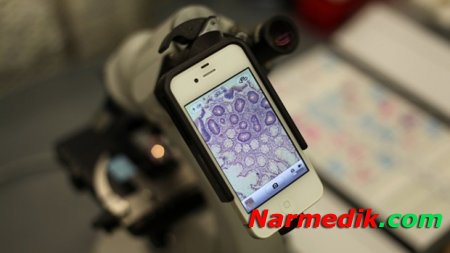 Микроскопы на смартфонах могут распознать рак кожи