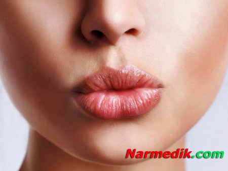 Обветренные губы: как быстро избавиться от проблемы